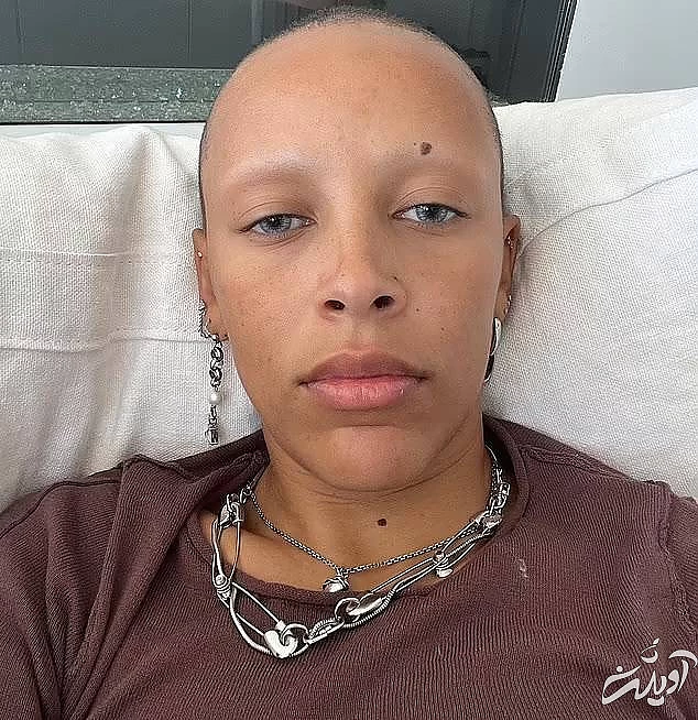 مد جدید ابرو سفید یا بدون ابرو چیست؟